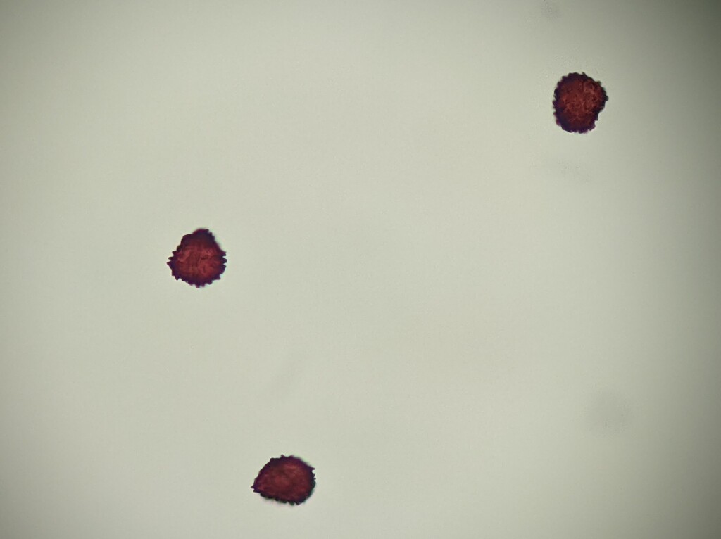 Fossombronia (hero image)
