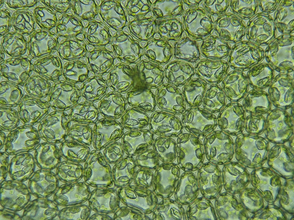 Plagiochilaceae (hero image)