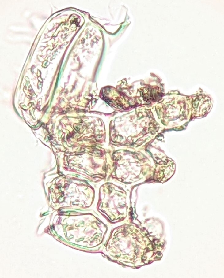 Drucella (hero image)