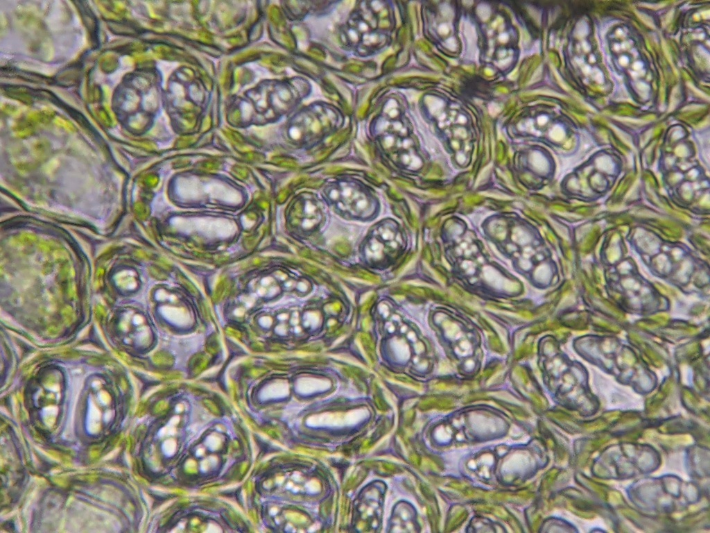 Cheilolejeunea mimosa (hero image)